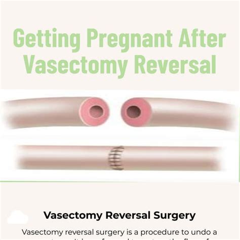 how likely is it to get pregnant after vasectomy reversal