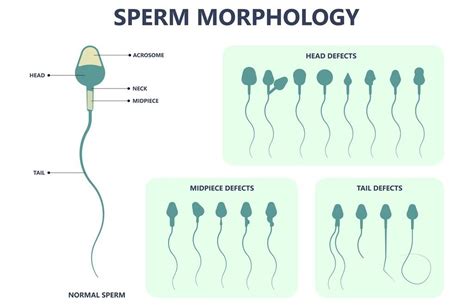how much does sperm morphology affect fertility