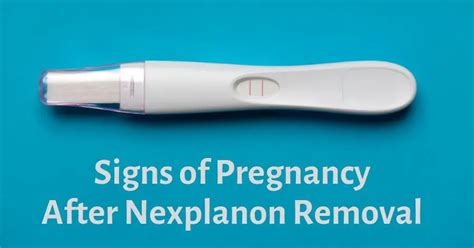 how to get pregnant fast after nexplanon removal