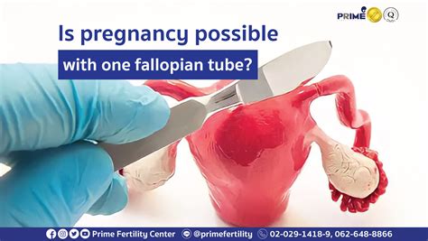 how to get pregnant with pcos and one fallopian tube